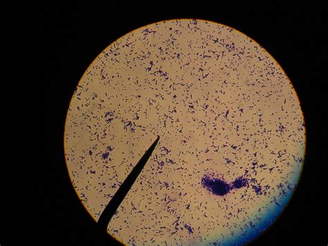 e coli simple stain